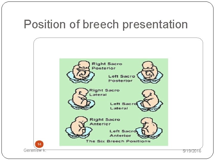 Position of breech presentation Geremew k. 5/19/2016 