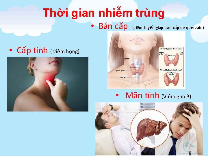 Thời gian nhiễm trùng • Bán cấp (viêm tuyến giáp bán cấp de quervain)