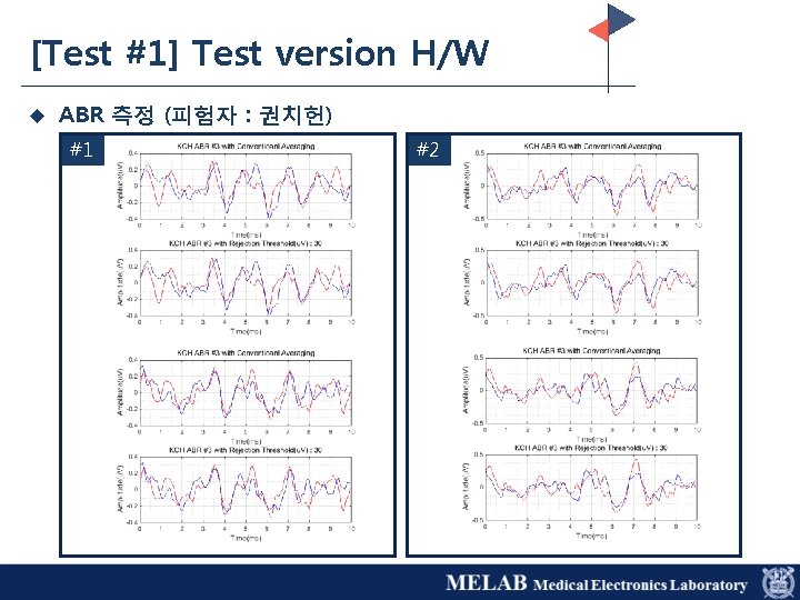 [Test #1] Test version H/W u ABR 측정 (피험자 : 권치헌) #1 #2 