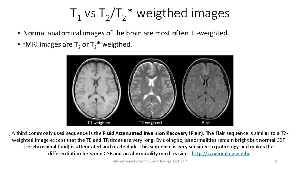 T 1 vs T 2/T 2* weigthed images • Normal anatomical images of the