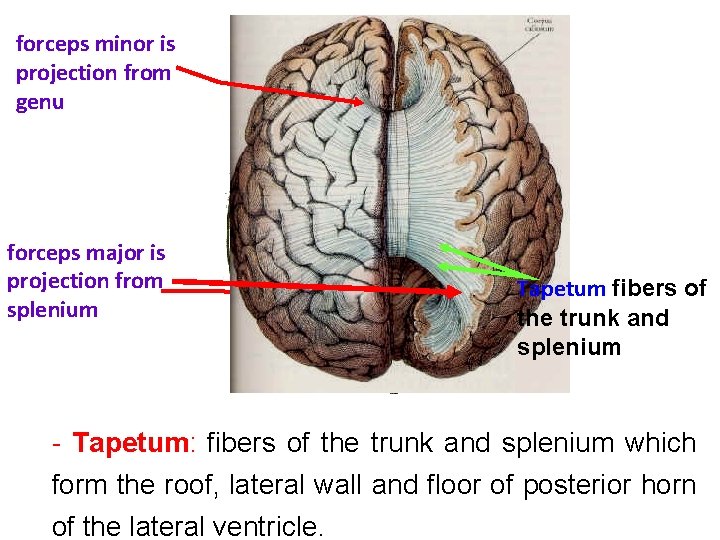 forceps minor is projection from genu forceps major is projection from splenium Tapetum fibers