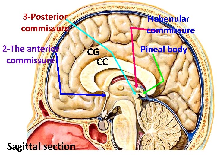 3 -Posterior commissure 2 -The anterior commissure Sagittal section Habenular commissure CG CC Pineal