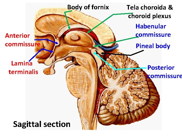 Body of fornix Anterior commissure Lamina terminalis Sagittal section Tela choroida & choroid plexus