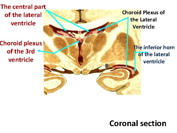 The central part of the lateral ventricle Choroid plexus of the 3 rd ventricle
