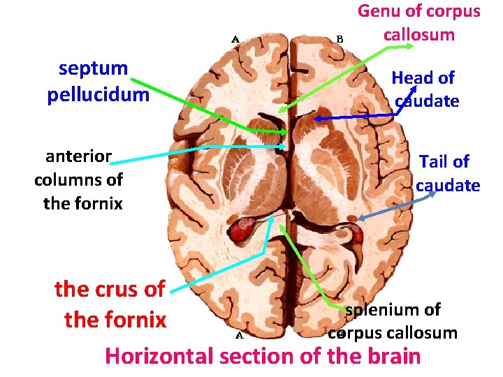 Genu of corpus callosum septum pellucidum anterior columns of the fornix Head of caudate