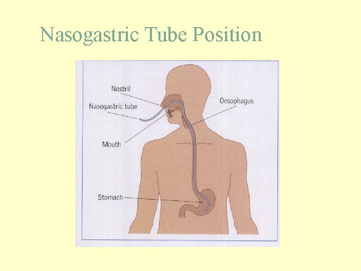 Nasogastric Tube Position 