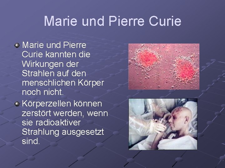 Marie und Pierre Curie kannten die Wirkungen der Strahlen auf den menschlichen Körper noch