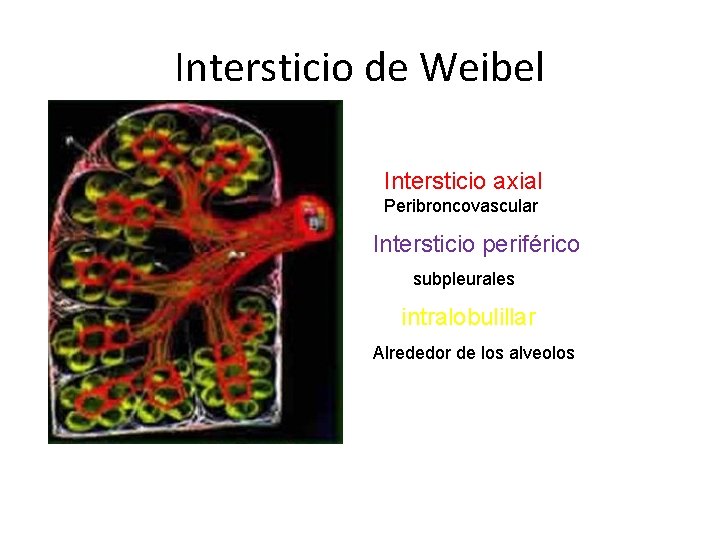 Intersticio de Weibel Intersticio axial Peribroncovascular Intersticio periférico subpleurales intralobulillar Alrededor de los alveolos