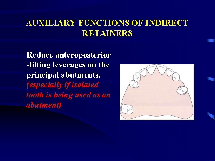 AUXILIARY FUNCTIONS OF INDIRECT RETAINERS Reduce anteroposterior -tilting leverages on the principal abutments. (especially