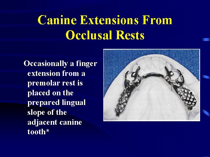Canine Extensions From Occlusal Rests Occasionally a finger extension from a premolar rest is