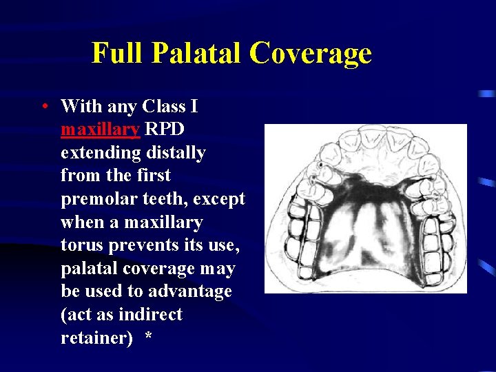 Full Palatal Coverage • With any Class I maxillary RPD extending distally from the