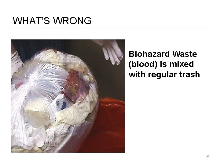WHAT’S WRONG Biohazard Waste (blood) is mixed with regular trash 45 