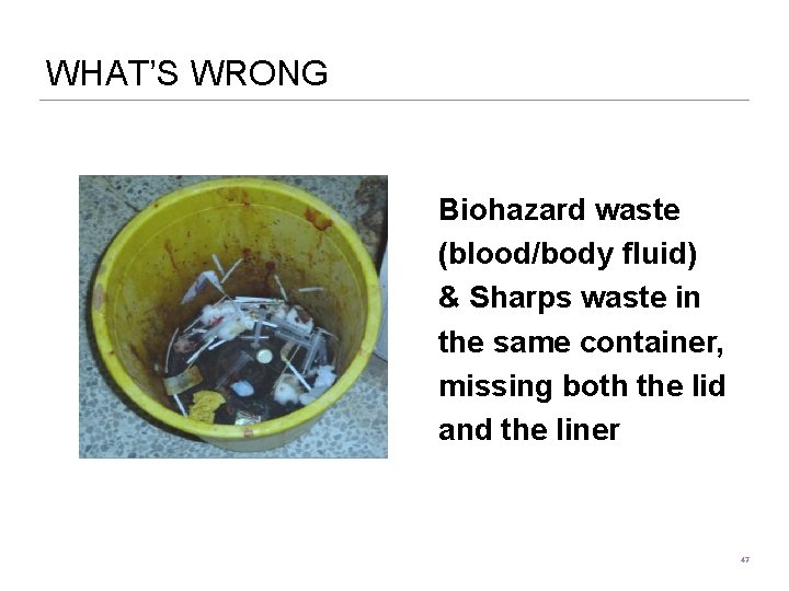 WHAT’S WRONG Biohazard waste (blood/body fluid) & Sharps waste in the same container, missing