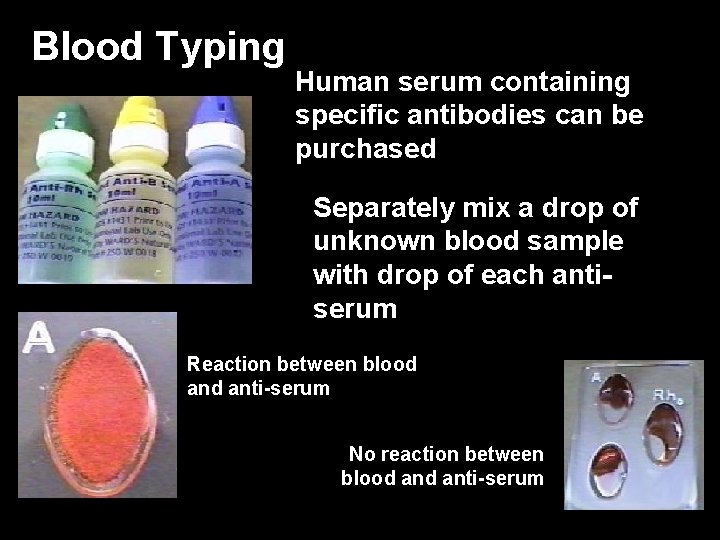 Blood Typing Human serum containing specific antibodies can be purchased Separately mix a drop