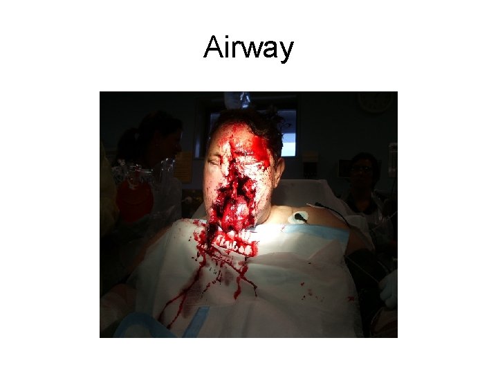 Airway 