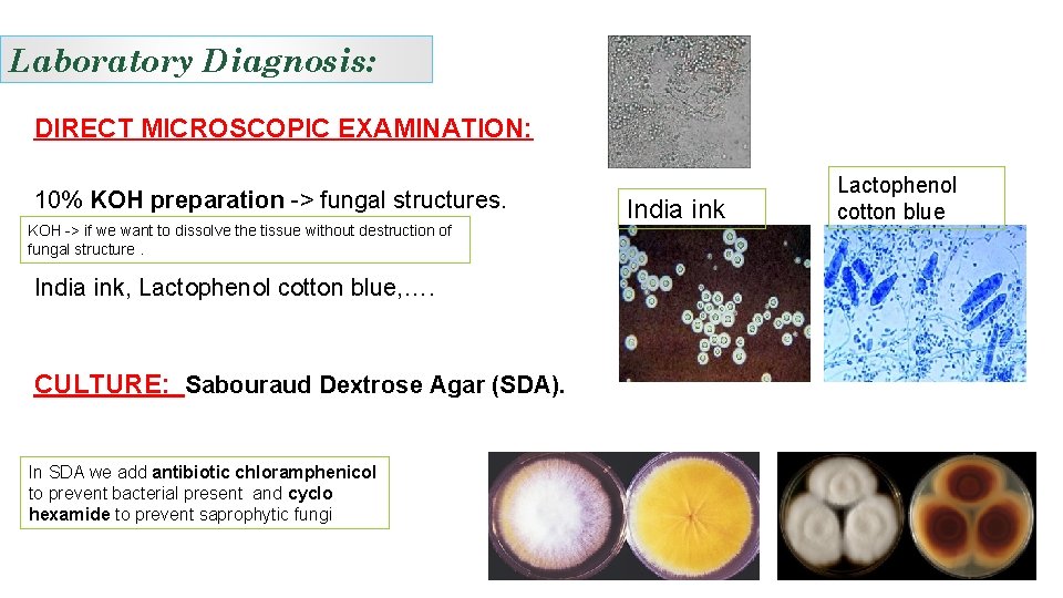 Laboratory Diagnosis: DIRECT MICROSCOPIC EXAMINATION: 10% KOH preparation -> fungal structures. KOH -> if