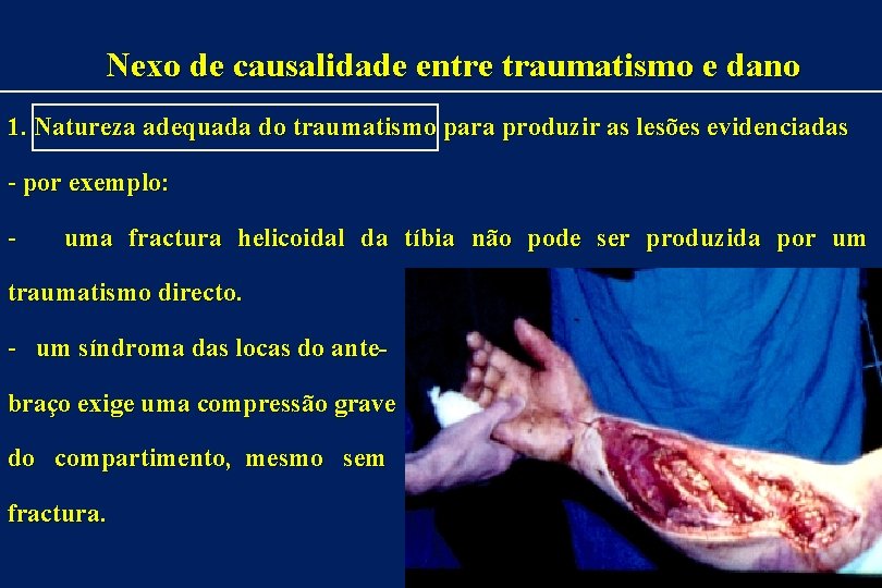 Nexo de causalidade entre traumatismo e dano 1. Natureza adequada do traumatismo para produzir