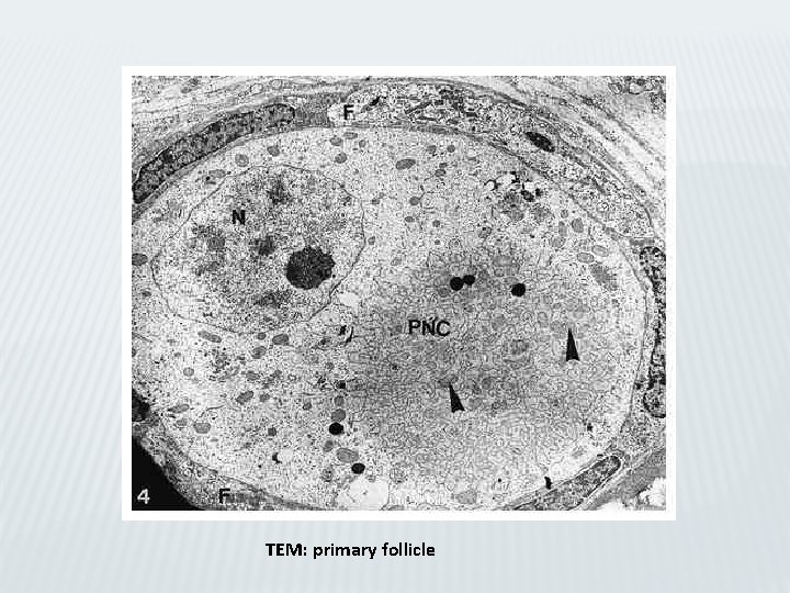 TEM: primary follicle 