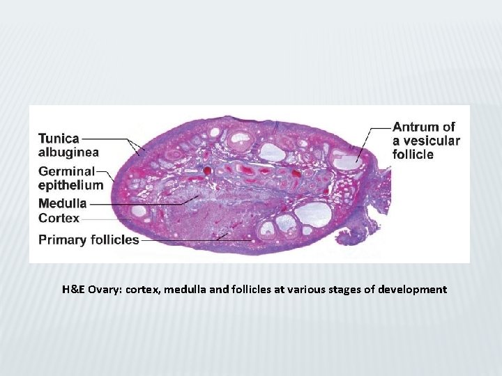 H&E Ovary: cortex, medulla and follicles at various stages of development 