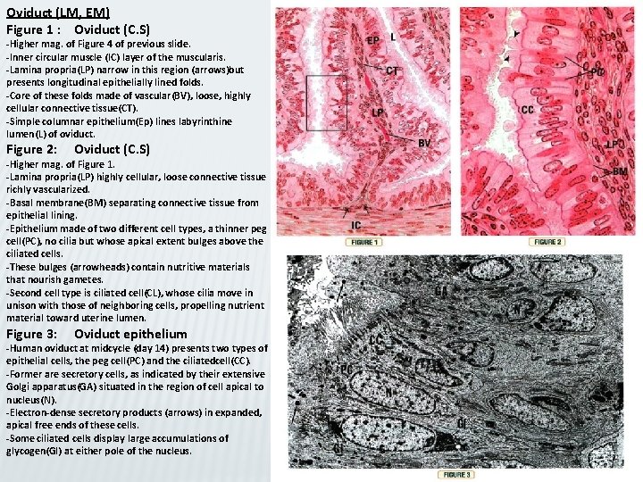 Oviduct (LM, EM) Figure 1 : Oviduct (C. S) -Higher mag. of Figure 4