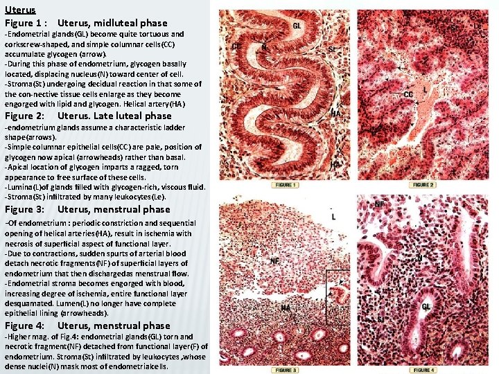 Uterus Figure 1 : Uterus, midluteal phase -Endometrial glands(GL) become quite tortuous and corkscrew-shaped,