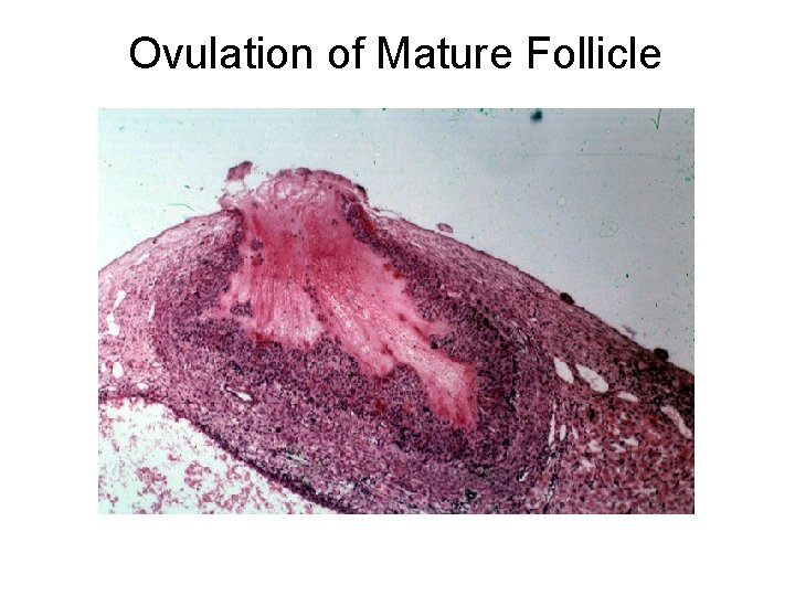 Ovulation of Mature Follicle 