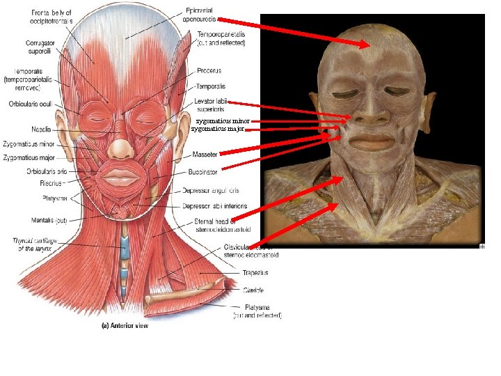 zygomaticus minor zygomaticus major 