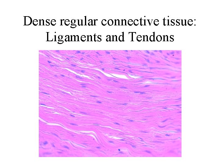 Dense regular connective tissue: Ligaments and Tendons 