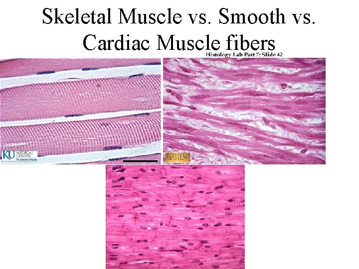 Skeletal Muscle vs. Smooth vs. Cardiac Muscle fibers 