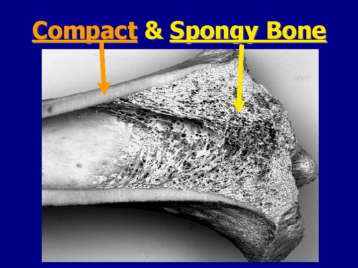Compact & Spongy Bone 