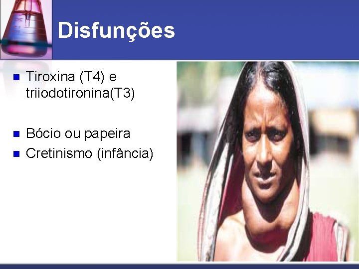 Disfunções n Tiroxina (T 4) e triiodotironina(T 3) n Bócio ou papeira Cretinismo (infância)