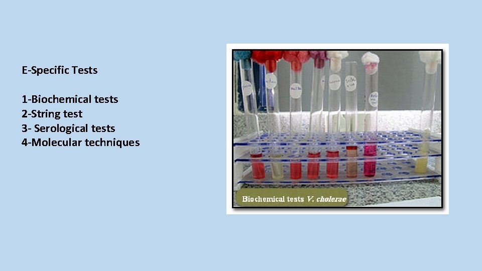 E-Specific Tests 1 -Biochemical tests 2 -String test 3 - Serological tests 4 -Molecular