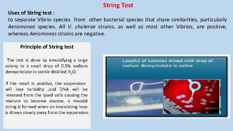 String Test Uses of String test : to separate Vibrio species from other bacterial