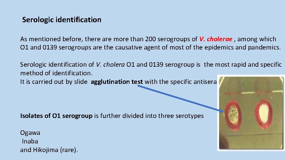 Serologic identification As mentioned before, there are more than 200 serogroups of V. cholerae