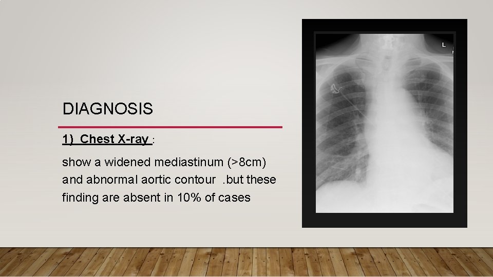 DIAGNOSIS 1) Chest X-ray : show a widened mediastinum (>8 cm) and abnormal aortic DIAGNOSIS 1) Chest X-ray : show a widened mediastinum (>8 cm) and abnormal aortic