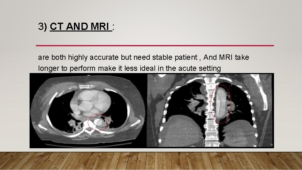 3) CT AND MRI : are both highly accurate but need stable patient , 3) CT AND MRI : are both highly accurate but need stable patient ,