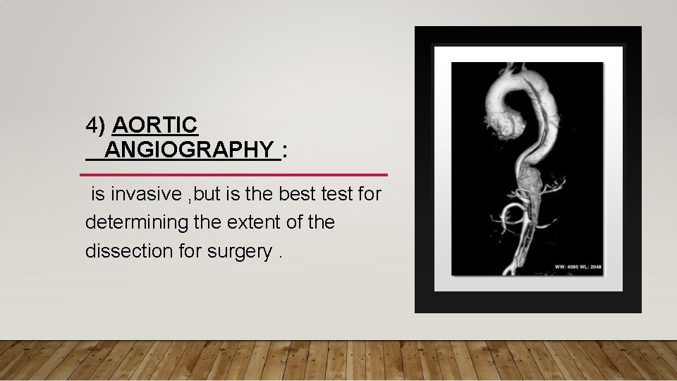 4) AORTIC ANGIOGRAPHY : is invasive , but is the best test for determining 4) AORTIC ANGIOGRAPHY : is invasive , but is the best test for determining