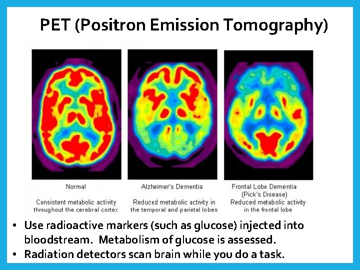 PET (Positron Emission Tomography) • Use radioactive markers (such as glucose) injected into bloodstream.