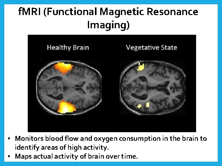 f. MRI (Functional Magnetic Resonance Imaging) • Monitors blood flow and oxygen consumption in