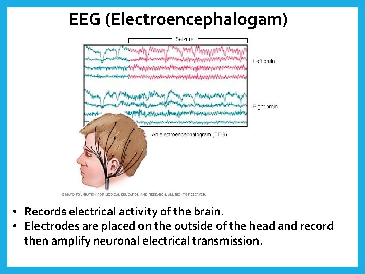 EEG (Electroencephalogam) • Records electrical activity of the brain. • Electrodes are placed on