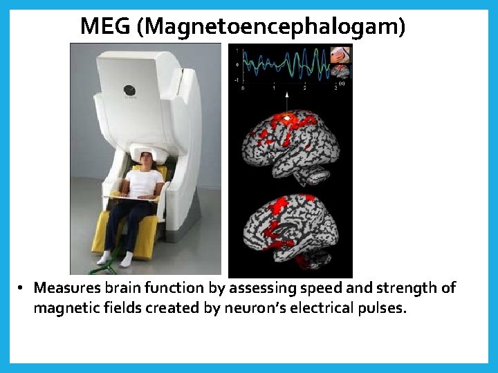 MEG (Magnetoencephalogam) • Measures brain function by assessing speed and strength of magnetic fields