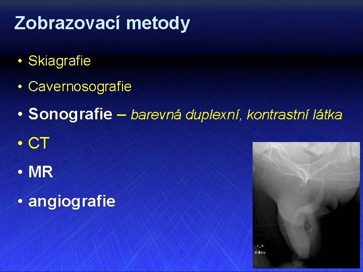 Zobrazovací metody • Skiagrafie • Cavernosografie • Sonografie – barevná duplexní, kontrastní látka •