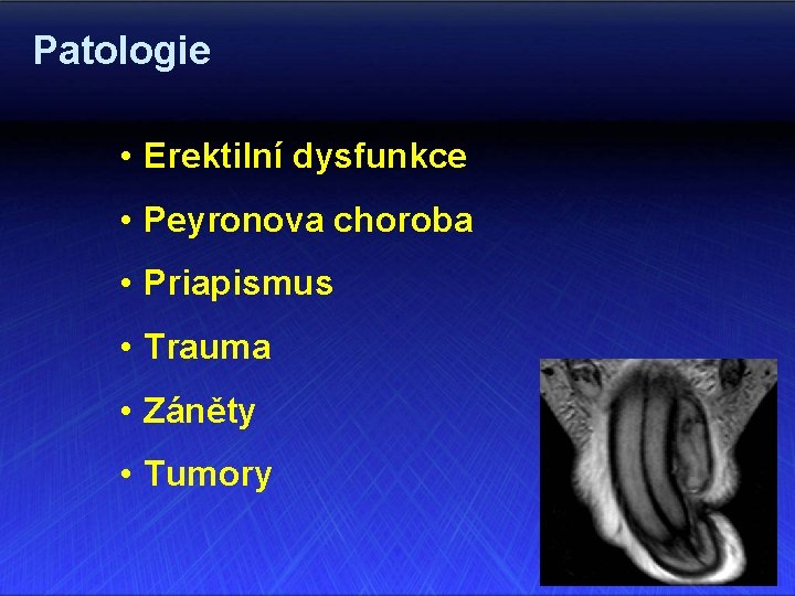 Patologie • Erektilní dysfunkce • Peyronova choroba • Priapismus • Trauma • Záněty •