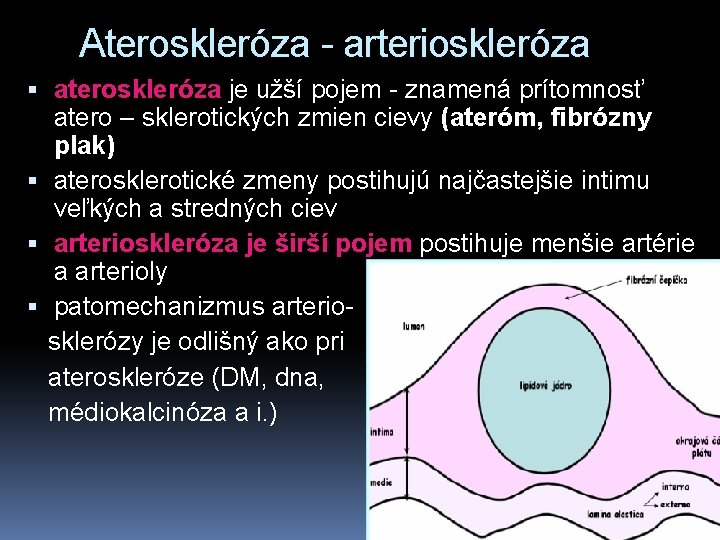 Ateroskleróza - arterioskleróza ateroskleróza je užší pojem - znamená prítomnosť atero – sklerotických zmien