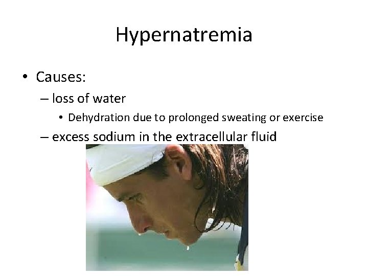 Hypernatremia • Causes: – loss of water • Dehydration due to prolonged sweating or