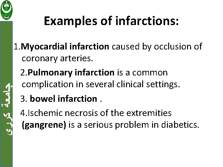Examples of infarctions: ﺟﺎﻣﻌﺔ ﻛﺮﺭﻱ 1. Myocardial infarction caused by occlusion of coronary arteries.