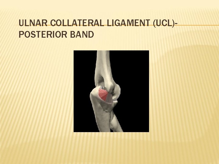 ULNAR COLLATERAL LIGAMENT (UCL)POSTERIOR BAND 