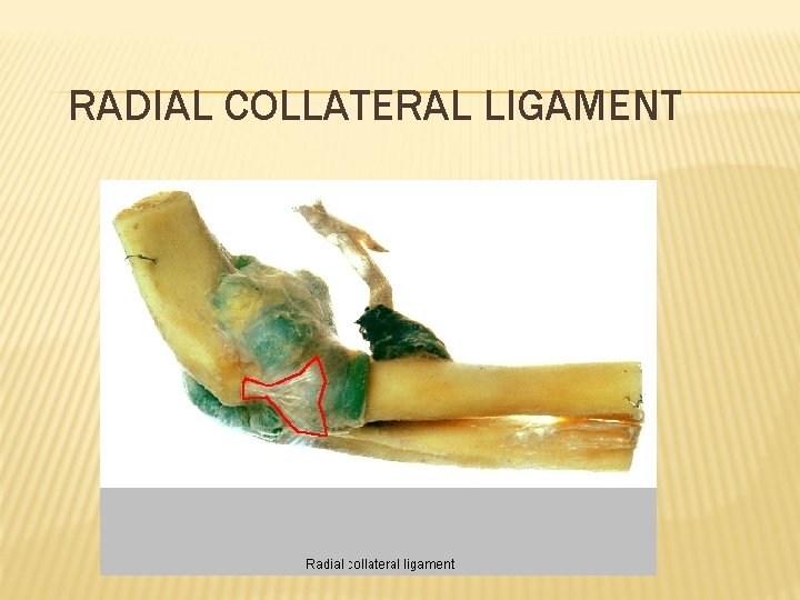 RADIAL COLLATERAL LIGAMENT 