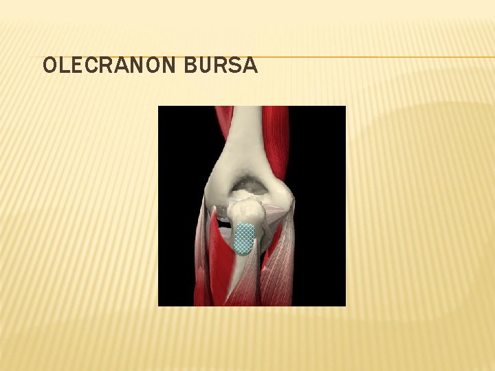 OLECRANON BURSA 