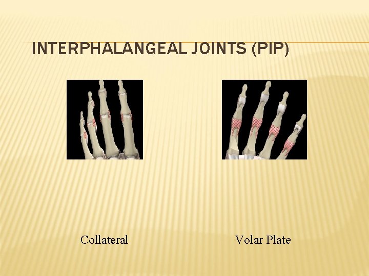 INTERPHALANGEAL JOINTS (PIP) Collateral Volar Plate 